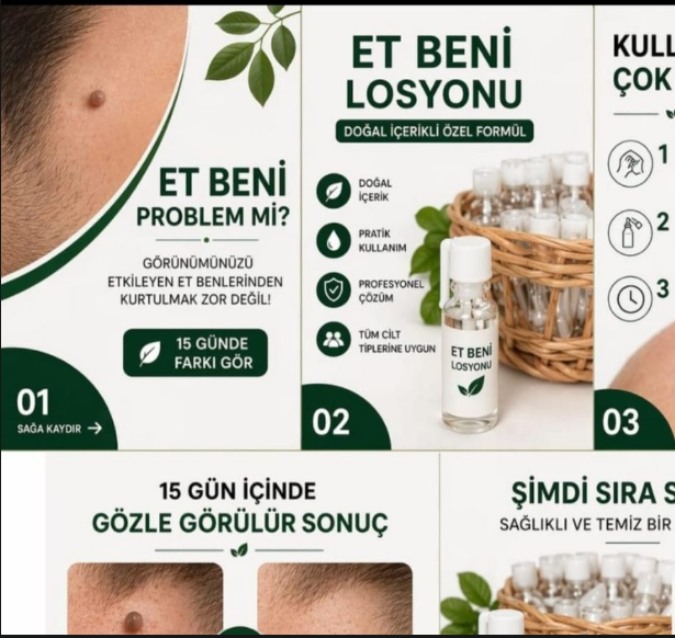 Et beni losyonu